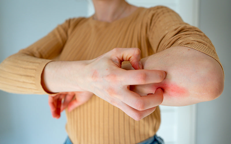 Food Allergy or Airborne Allergy: A Guide to Understanding Common Allergies