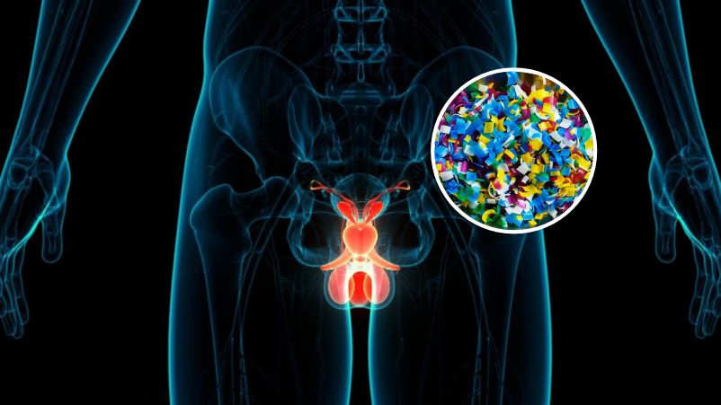 Mikroplastik Ditemukan di Testis Manusia: Ancaman terhadap Kesehatan Kesuburan